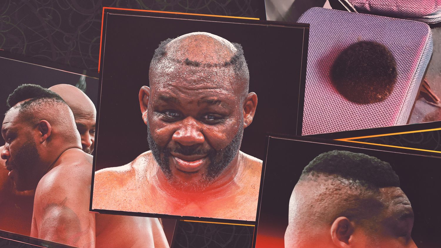 Jarrell Miller's return fueled by a viral toupee 1